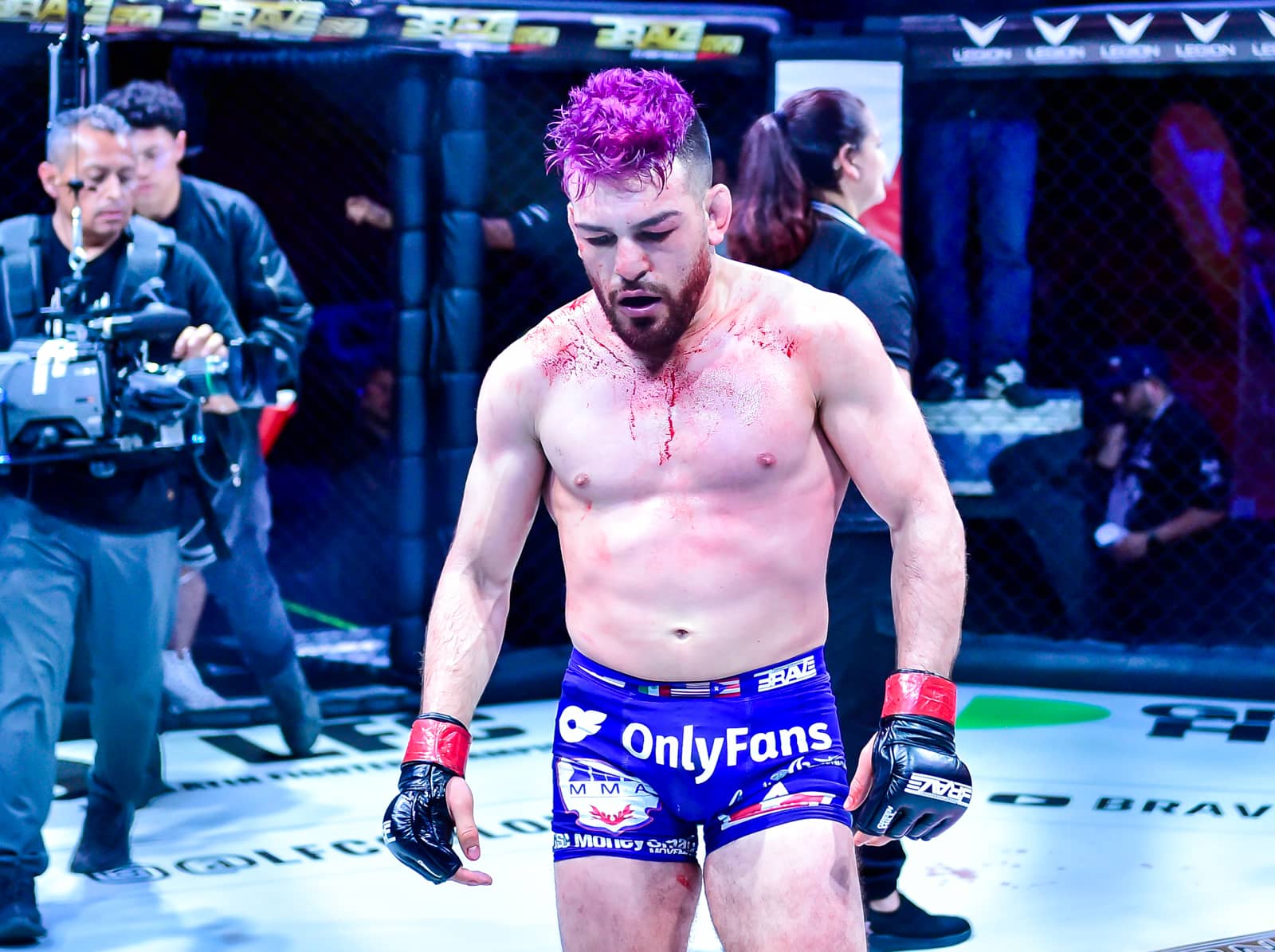 Jose Torres reveals shocking injury that almost ruined BRAVE CF 73 main event