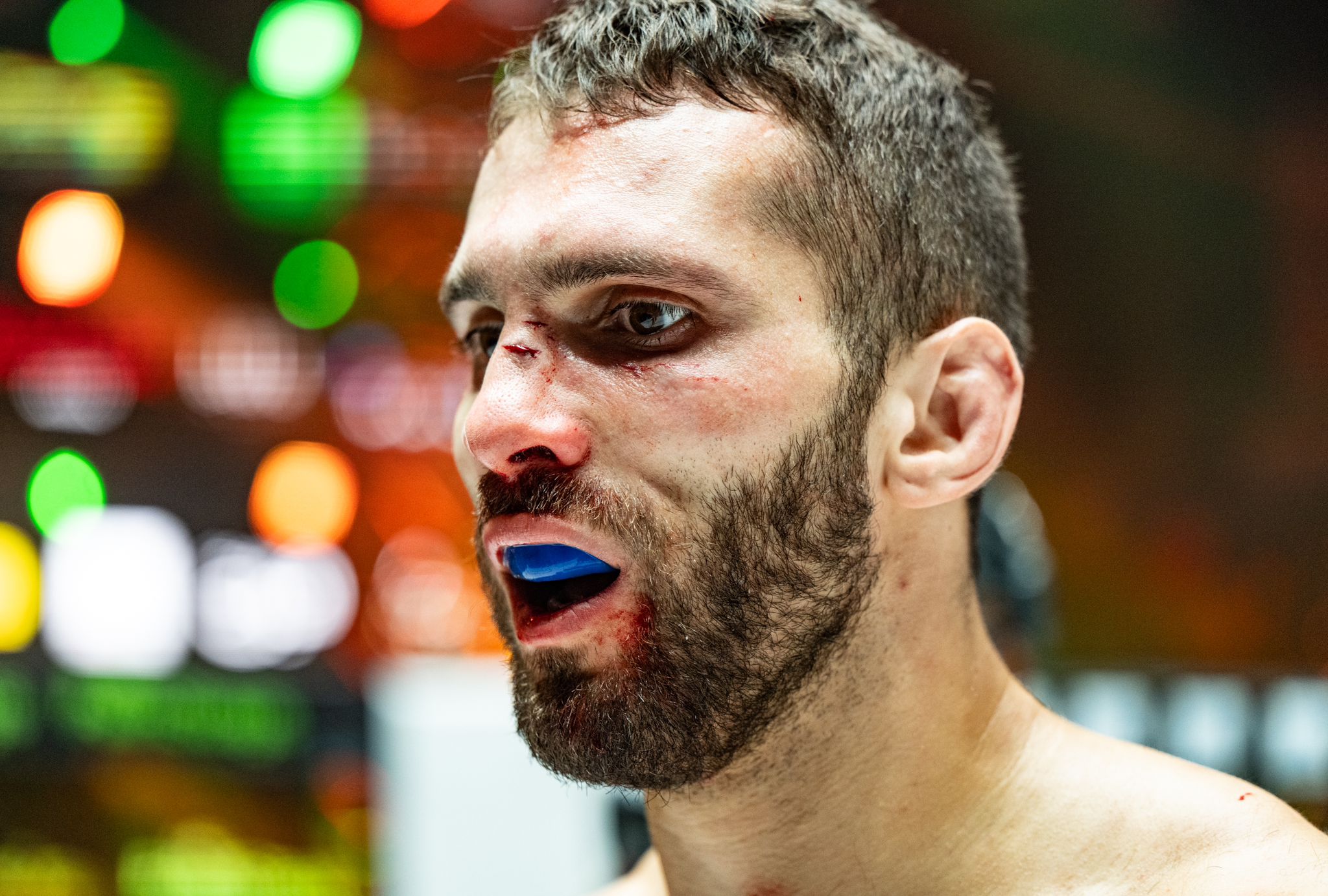 Rami Hamed Provides Nose Injury Update, Expects Return and Title Fight in April