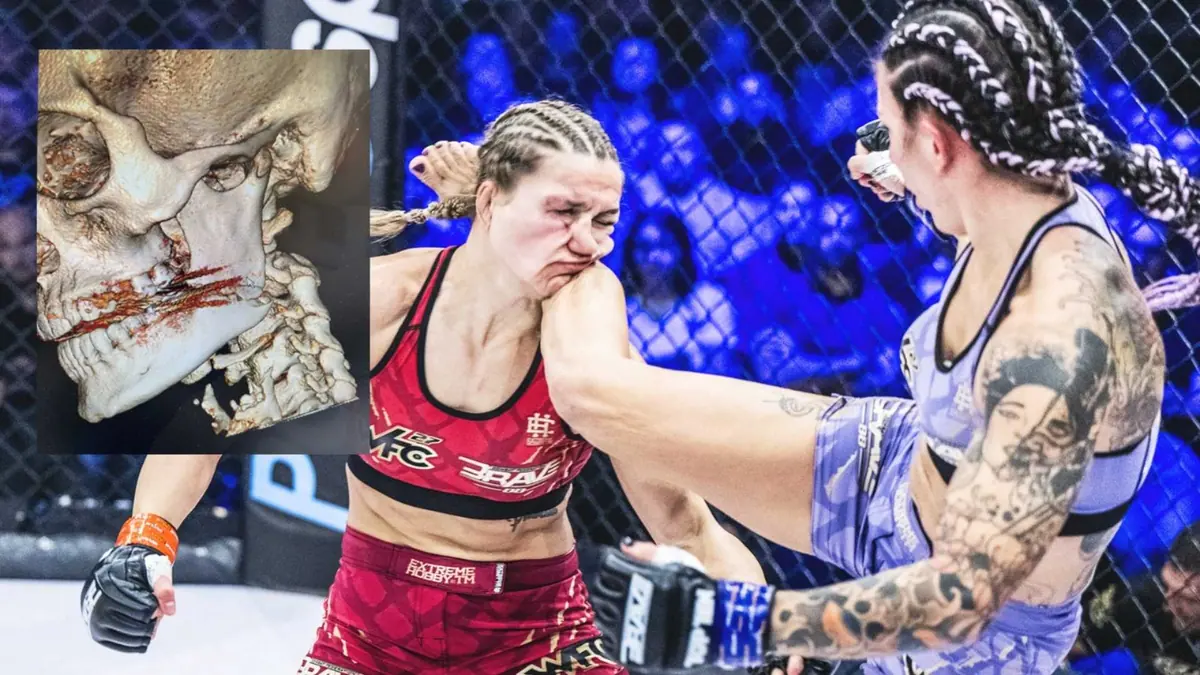 REVEALED: Monika Kucinic won at BRAVE CF 88 despite suffering a broken jaw in the first round